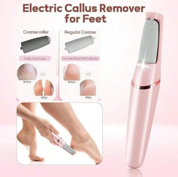 Rechargeable Callus Remover – Portable Foot Care Device For Smooth And Soft Skin